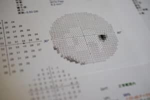 Visual field testing at Tower Clock Eye Center