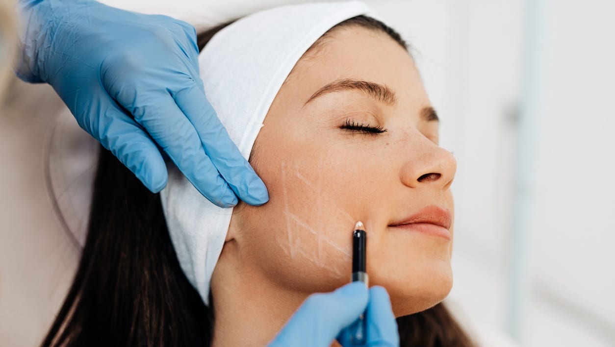 Facial Fat Grafting