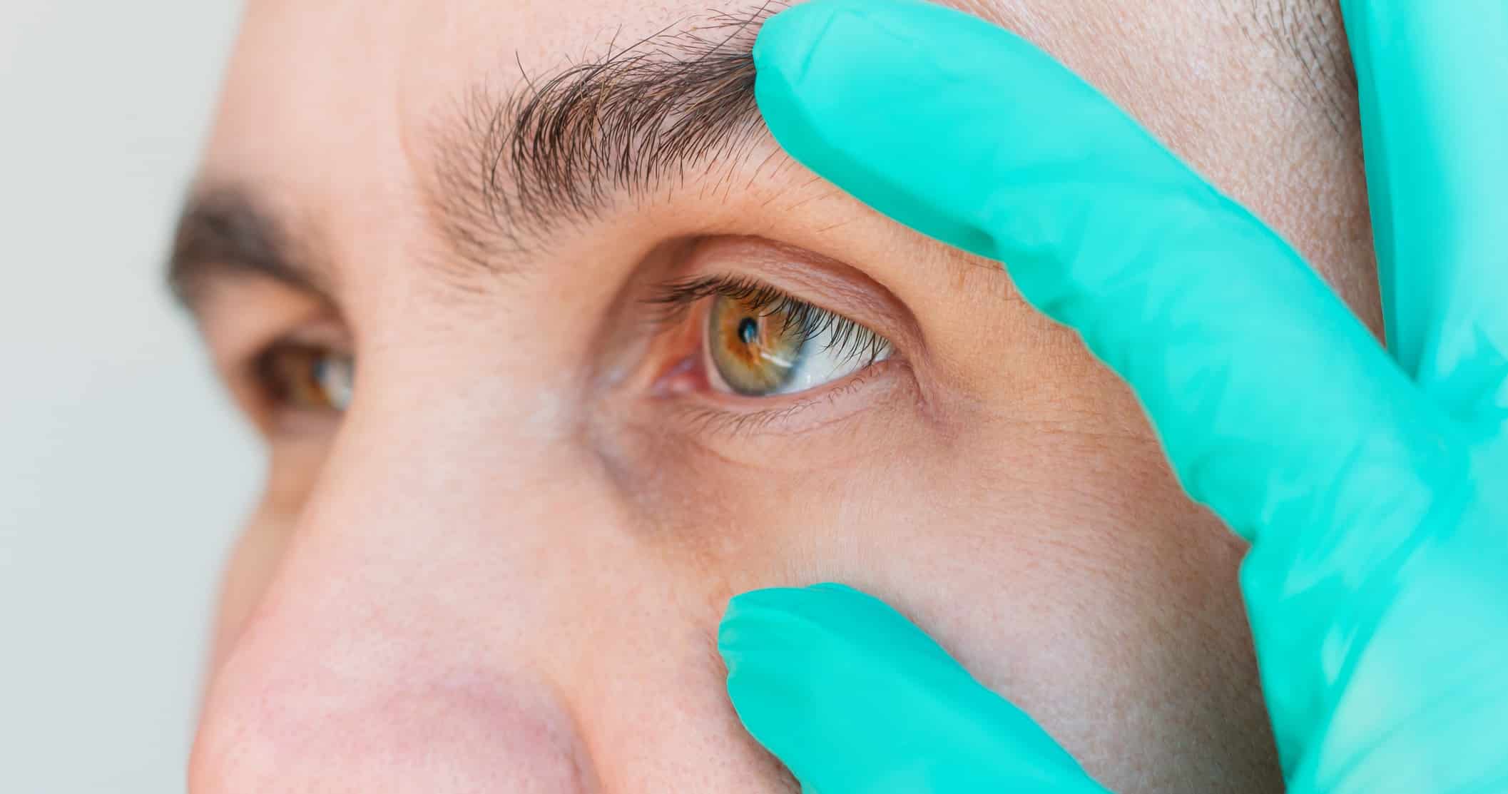 Oculofacial Plastic & Reconstructive Surgery